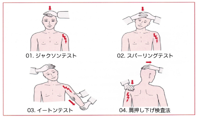椎間板ヘルニア - 整体・鍼灸なら実績と信頼の「メディカルジャパン国分寺」